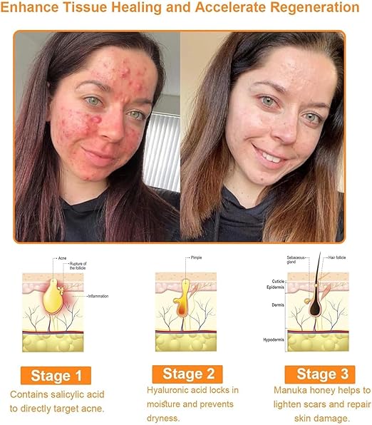 Bee Venom Cream for All Body Parts